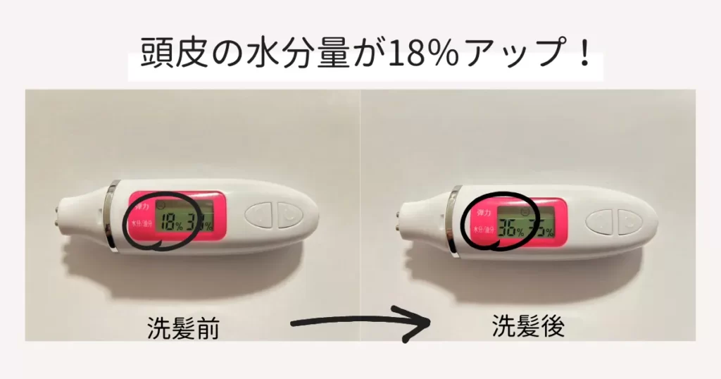 水分チェッカーで頭皮の潤いをチェック